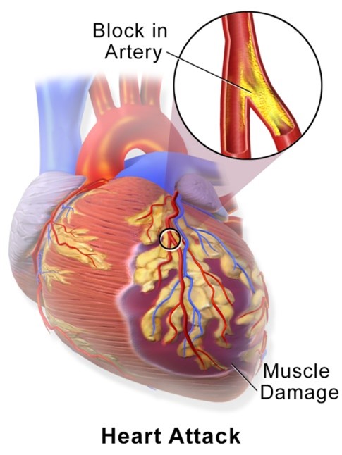 Heart - Indelible Learning