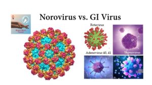 Difference Between Norovirus & GI Virus & How to Prevent Outbreak?